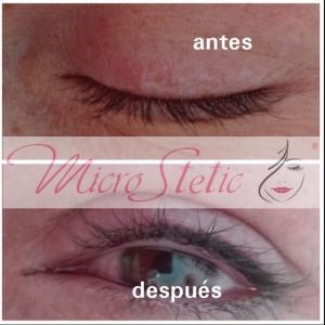 micropigmentación-madrid-ojos-eyeliner-fotos-dolor-antes-después
